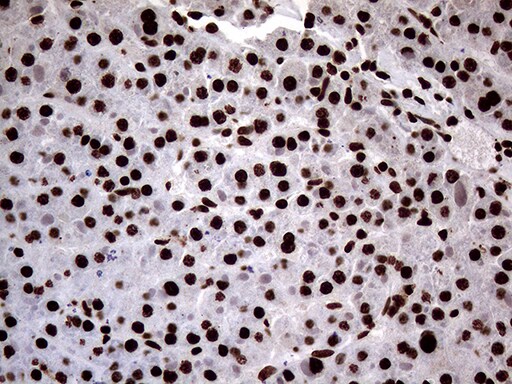 SH3BGRL Antibody (OTI8F7)