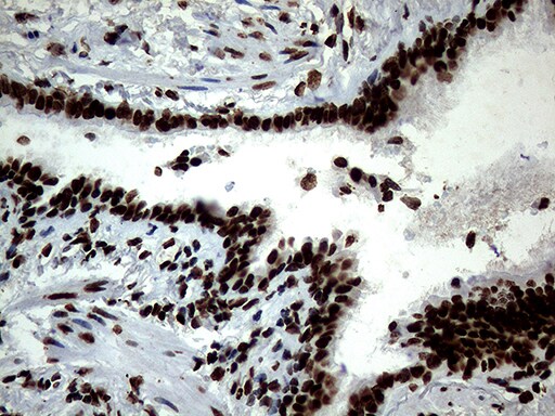 SH3BGRL Antibody (OTI8F7)