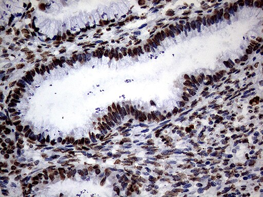 SH3BGRL Antibody (OTI8F7) Immunohistochemistry;SH3BGRL Antibody (OTI8F7)[NBP3-45012]-