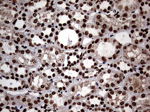 SH3BGRL Antibody (OTI8F7) Immunohistochemistry;SH3BGRL Antibody (OTI8F7)[NBP3-45012]-