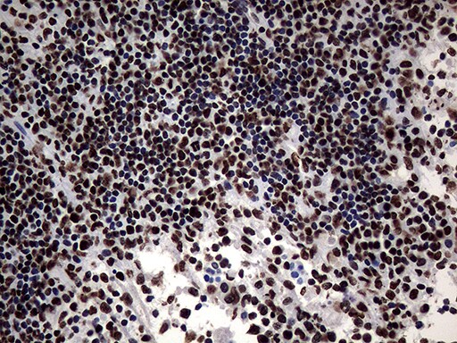 SH3BGRL Antibody (OTI8F7) Immunohistochemistry;SH3BGRL Antibody (OTI8F7)[NBP3-45012]-