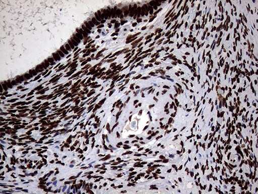 SH3BGRL Antibody (OTI8F7) Immunohistochemistry;SH3BGRL Antibody (OTI8F7)[NBP3-45012]-