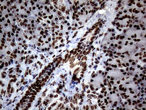 SH3BGRL Antibody (OTI8F7) Immunohistochemistry;SH3BGRL Antibody (OTI8F7)[NBP3-45012]-