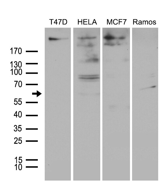 MTA3 Antibody (OTI2B8) Western Blot;MTA3 Antibody (OTI2B8)[NBP3-45015]-