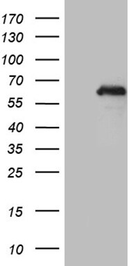 MTA3 Antibody (OTI2B8) Western Blot;MTA3 Antibody (OTI2B8)[NBP3-45015]-