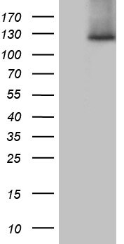SUPT16H Antibody (OTI3B8) Western Blot;SUPT16H Antibody (OTI3B8)[NBP3-45016]-