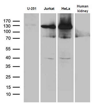 SUPT16H Antibody (OTI3B8) Western Blot;SUPT16H Antibody (OTI3B8)[NBP3-45016]-