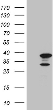PHF20L1 Antibody (OTI1B4) Western Blot;PHF20L1 Antibody (OTI1B4)[NBP3-45018]-