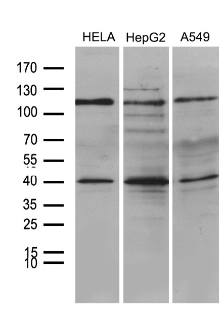 PHF20L1 Antibody (OTI1B4) Western Blot;PHF20L1 Antibody (OTI1B4)[NBP3-45018]-