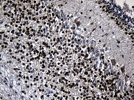 PHF20L1 Antibody (OTI1H6) Immunohistochemistry;PHF20L1 Antibody (OTI1H6)[NBP3-45019]-