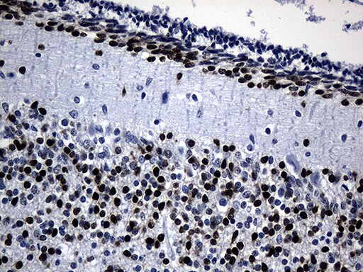PHF20L1 Antibody (OTI6G6) Immunohistochemistry;PHF20L1 Antibody (OTI6G6)[NBP3-45020]-