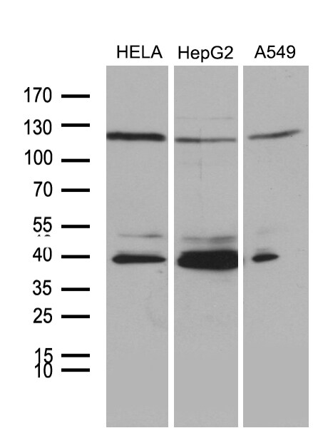 PHF20L1 Antibody (OTI6G6) Western Blot;PHF20L1 Antibody (OTI6G6)[NBP3-45020]-