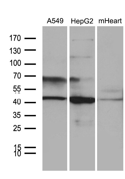 FBXO22 Antibody (OTI1H1) Western Blot;FBXO22 Antibody (OTI1H1)[NBP3-45022]-