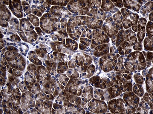 TIN2 Antibody (OTI2C12) Immunohistochemistry;TIN2 Antibody (OTI2C12)[NBP3-45024]-