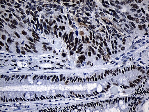 SUPT16H Antibody (OTI8A1) Immunohistochemistry;SUPT16H Antibody (OTI8A1)[NBP3-45025]-