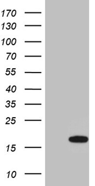 VPREB3 Antibody (OTI1A3) Western Blot;VPREB3 Antibody (OTI1A3)[NBP3-45027]-