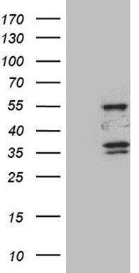 SPAG4 Antibody (OTI3E9) Western Blot;SPAG4 Antibody (OTI3E9)[NBP3-45032]-