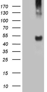 TAT Antibody (OTI3G6) Western Blot;TAT Antibody (OTI3G6)[NBP3-45037]-