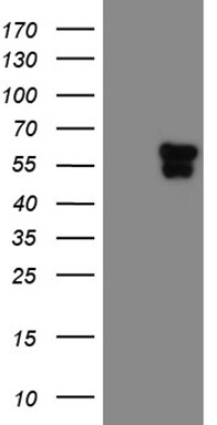 TEKT2 Antibody (OTI1E11) Western Blot;TEKT2 Antibody (OTI1E11)[NBP3-45043]-