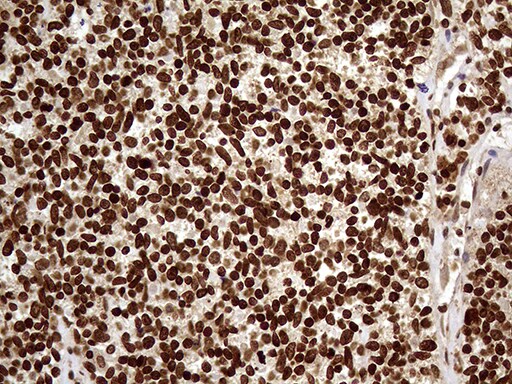 DDX19A Antibody (OTI3C12) Immunohistochemistry;DDX19A Antibody (OTI3C12)[NBP3-45044]-