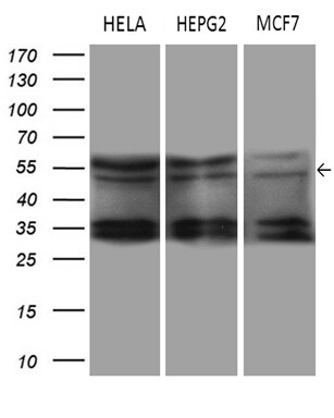 DDX19A Antibody (OTI3C12) Western Blot;DDX19A Antibody (OTI3C12)[NBP3-45044]-