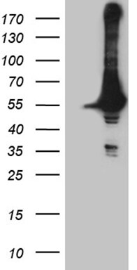 DDX19A Antibody (OTI3C12) Western Blot;DDX19A Antibody (OTI3C12)[NBP3-45044]-