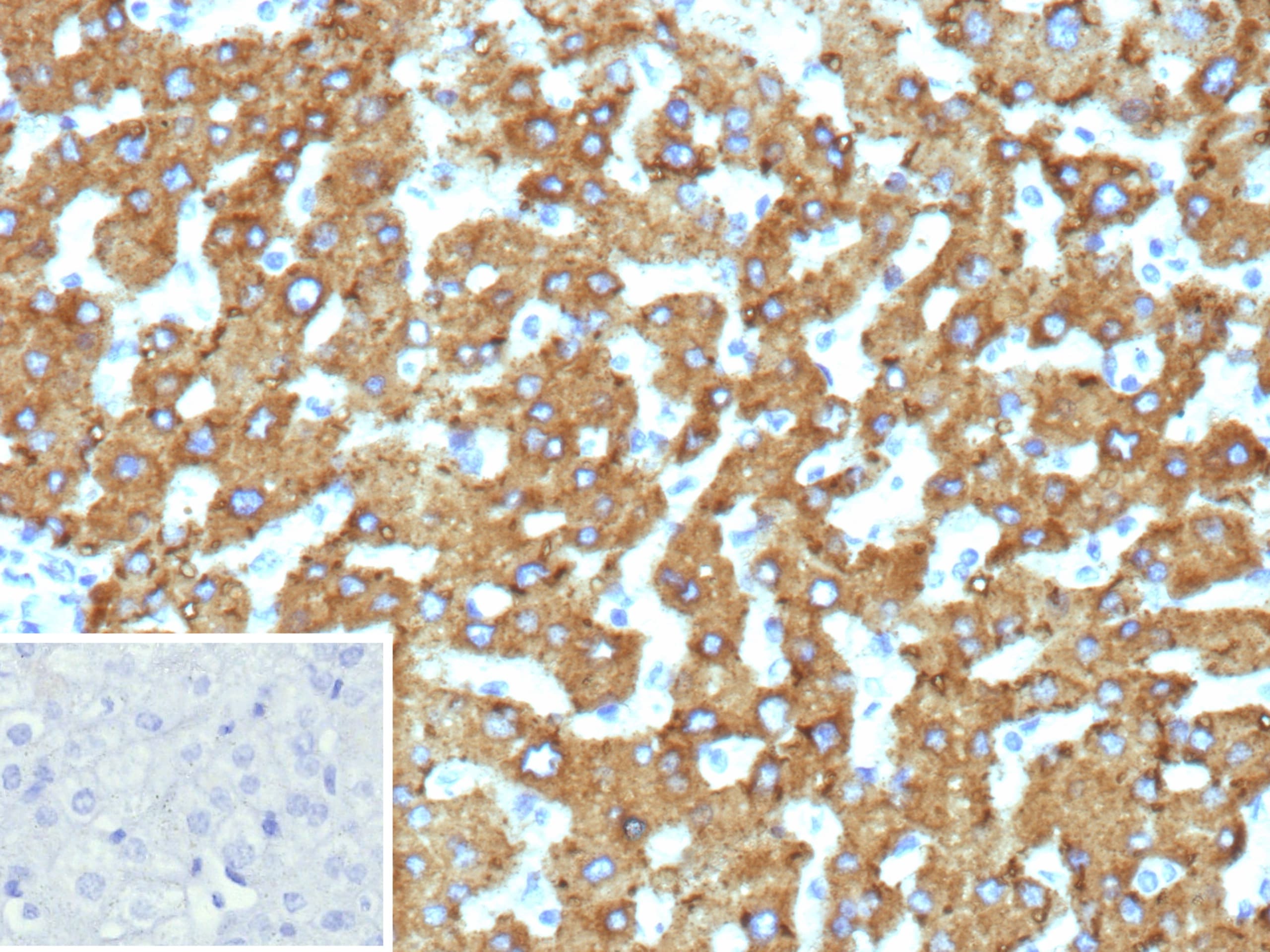 HSD17B13 Antibody (HSD17B13/13104) - Azide and BSA Free