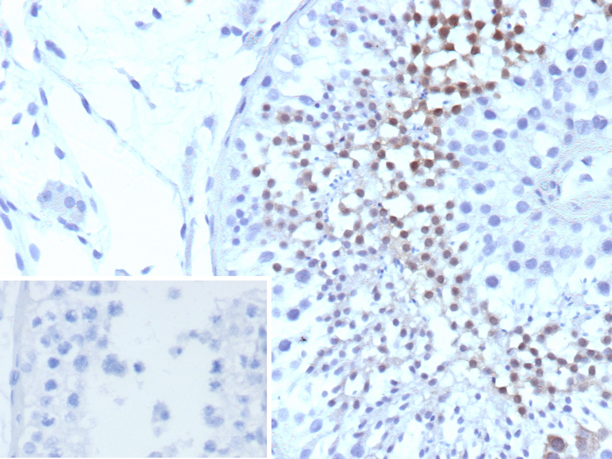 Centrin 1 Antibody (CETN1/9880) - Azide and BSA Free