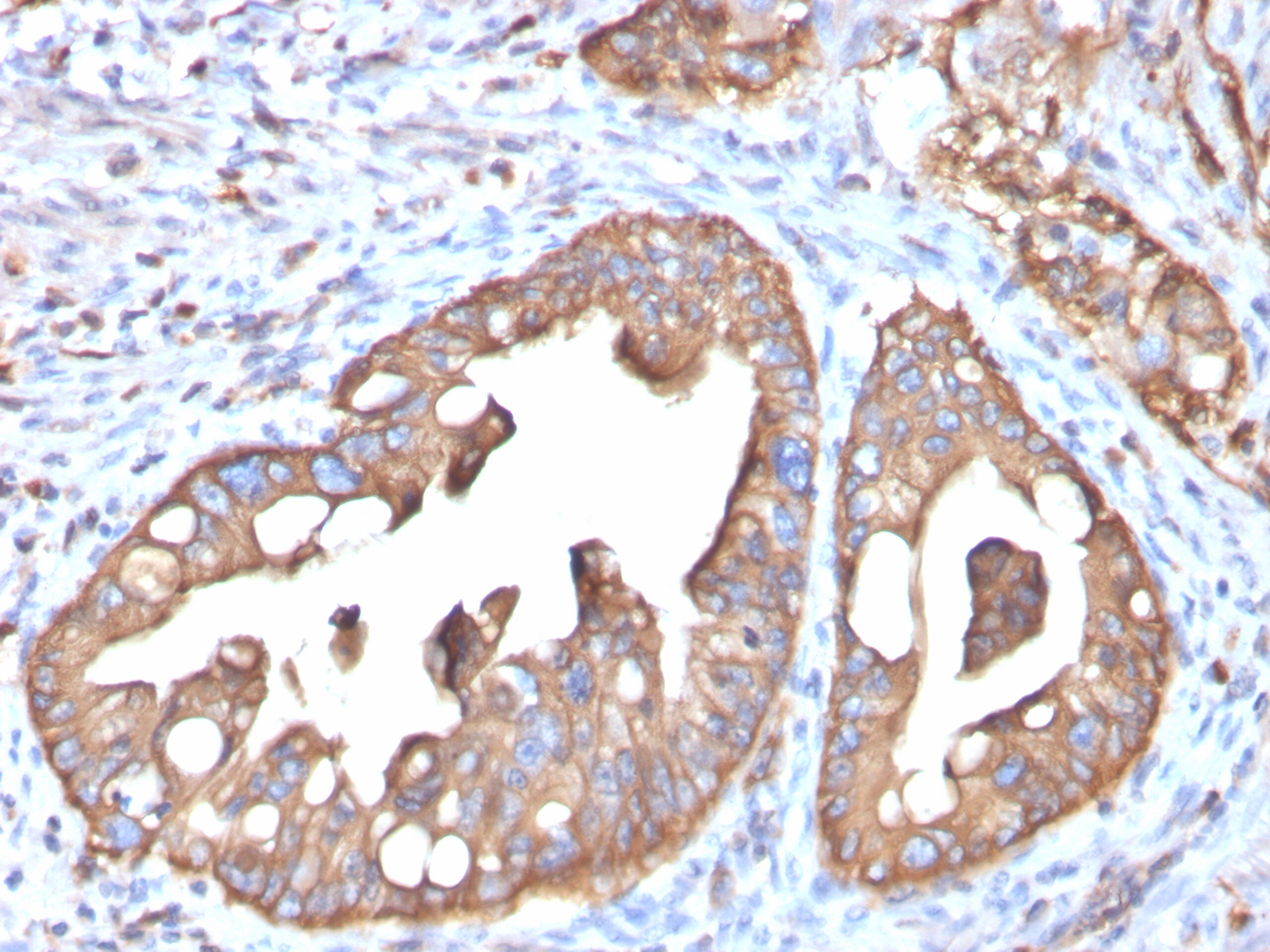 Aquaporin-4 Antibody (AQP4/3323) - Azide and BSA Free