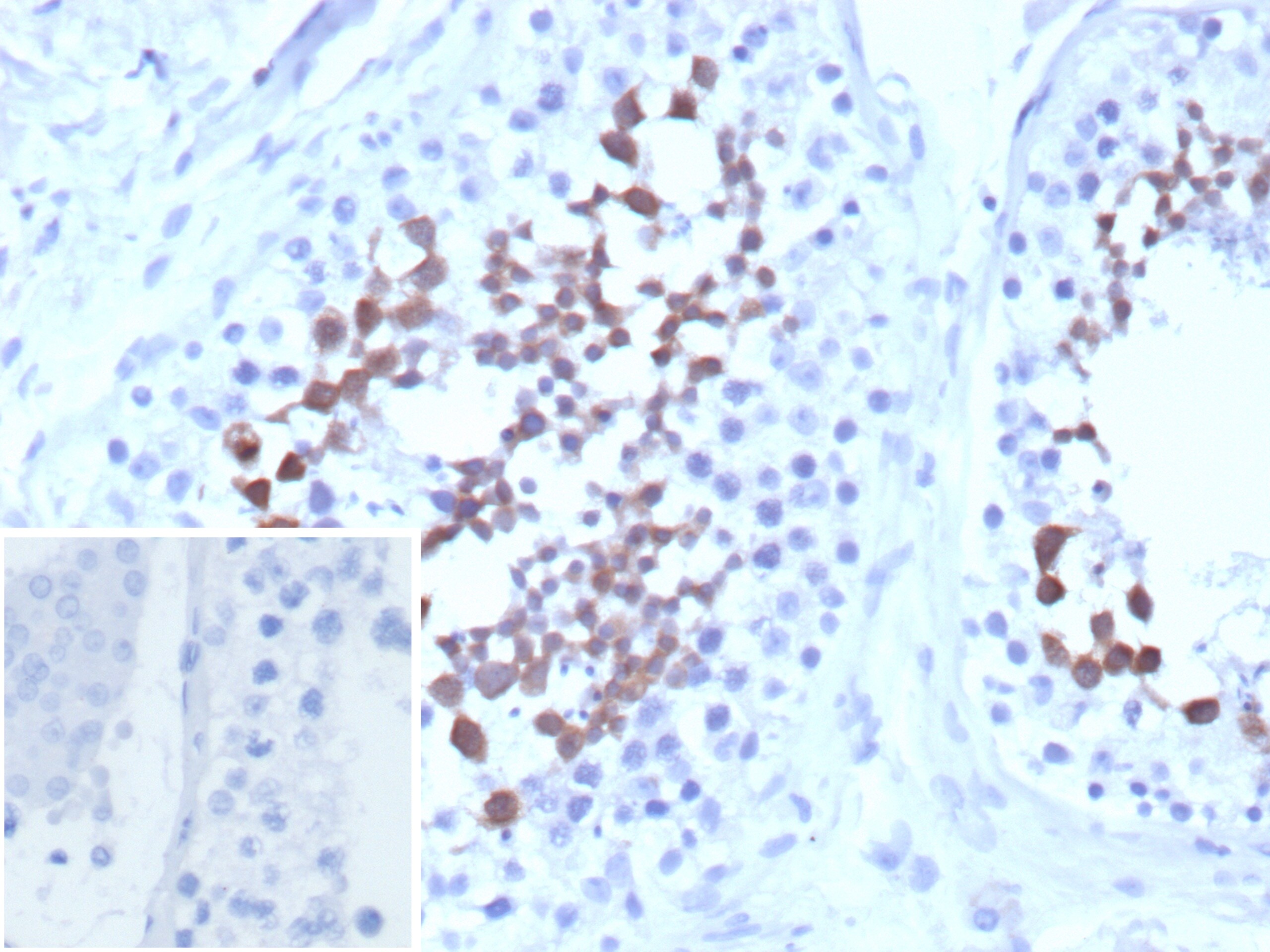 Centrin 1 Antibody (CETN1/9878) - Azide and BSA Free