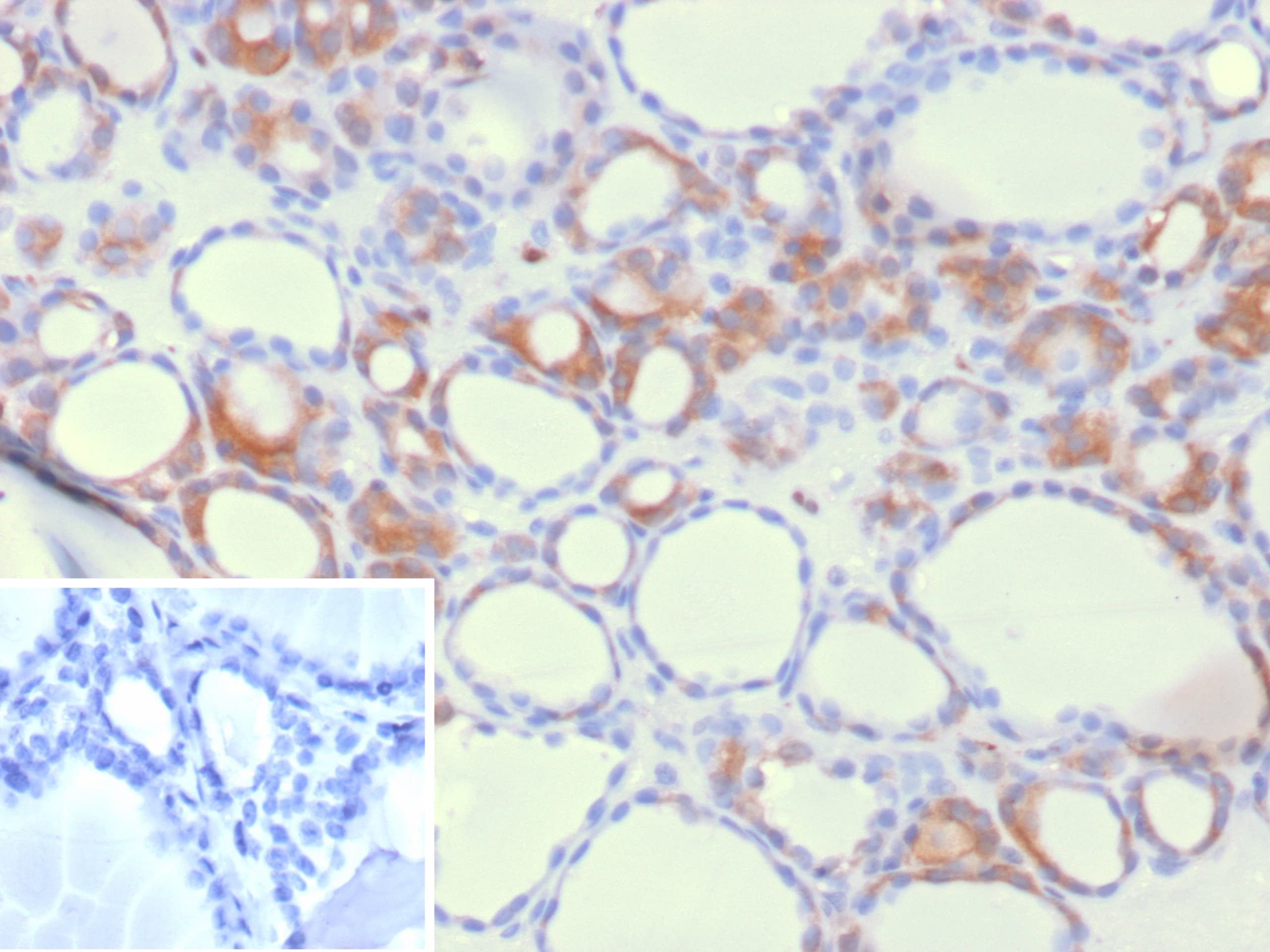 HEG1 Antibody (HEG1/9445) - Azide and BSA Free