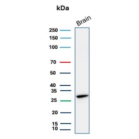 Calbindin D-28K Antibody (rCALB1/13280) - Azide and BSA Free