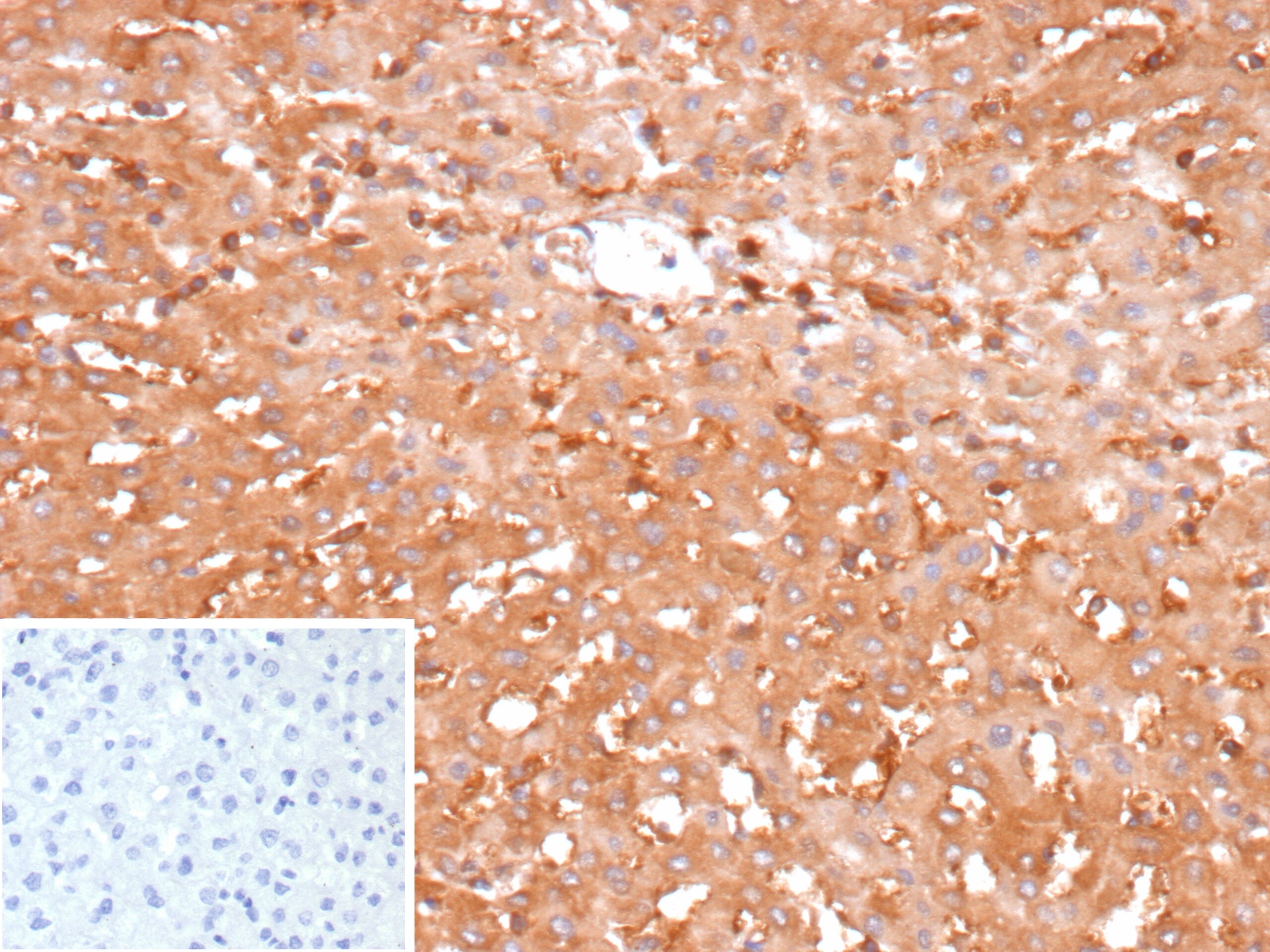 Glucose 6 phosphate isomerase Antibody (GPI/2439) - Azide and BSA Free