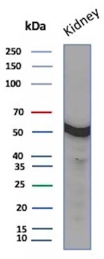 Glucose 6 phosphate isomerase Antibody (GPI/2439) - Azide and BSA Free