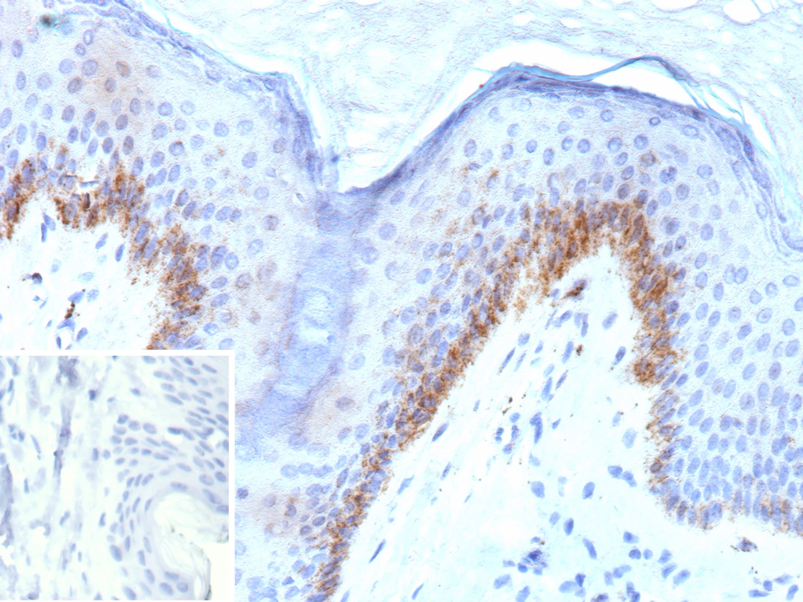 Kallikrein 4/Prostase/EMSP1 Antibody (KLK4/8943) - Azide and BSA Free