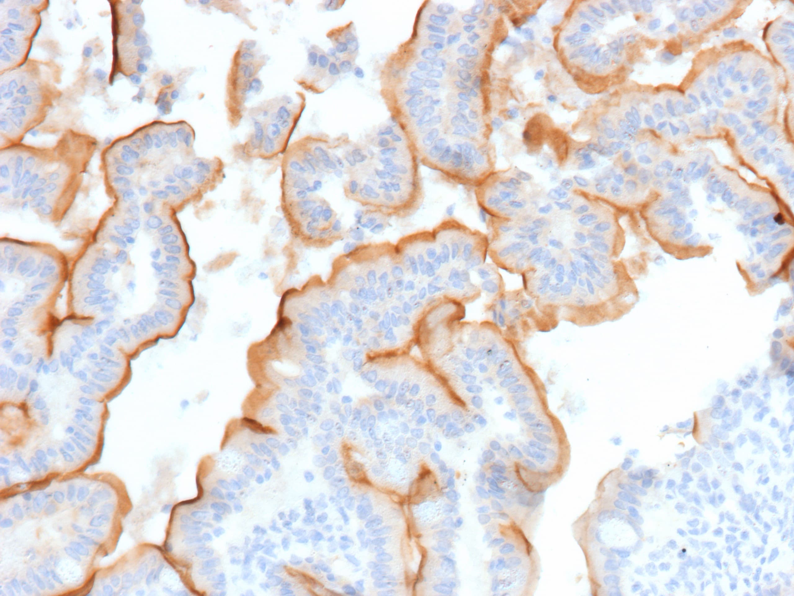 MUC13 Antibody (MUC13/13112) - Azide and BSA Free