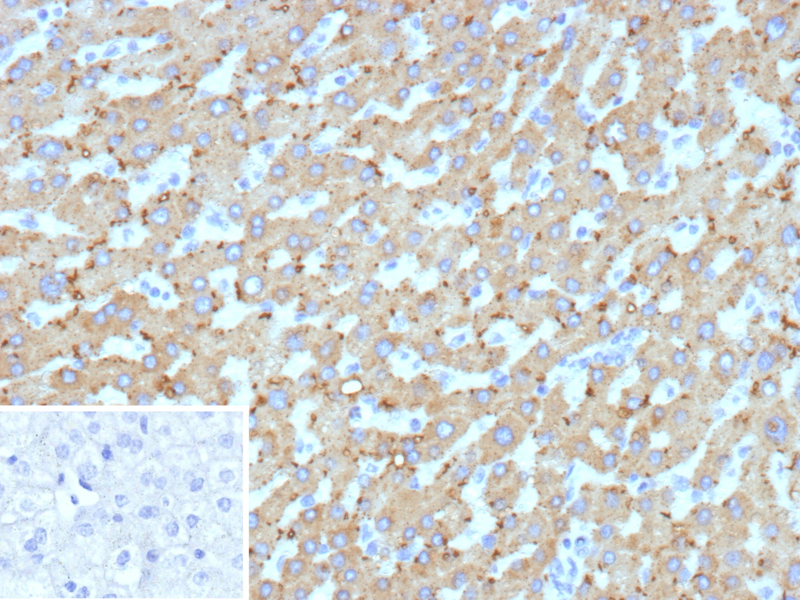 HSD17B13 Antibody (HSD17B13/13110) - Azide and BSA Free