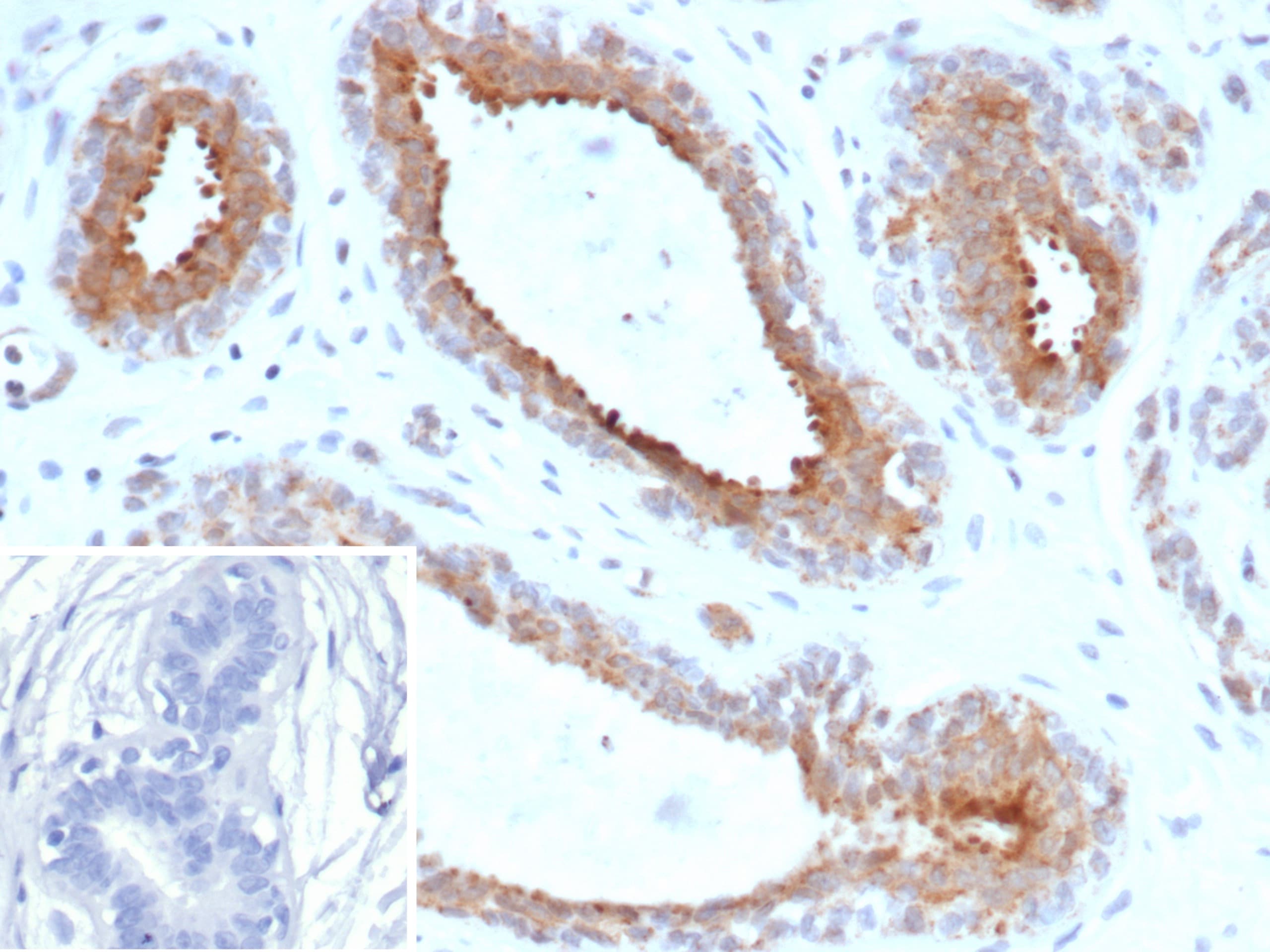BAP1 Antibody (BAP1/13501R) - Azide and BSA Free