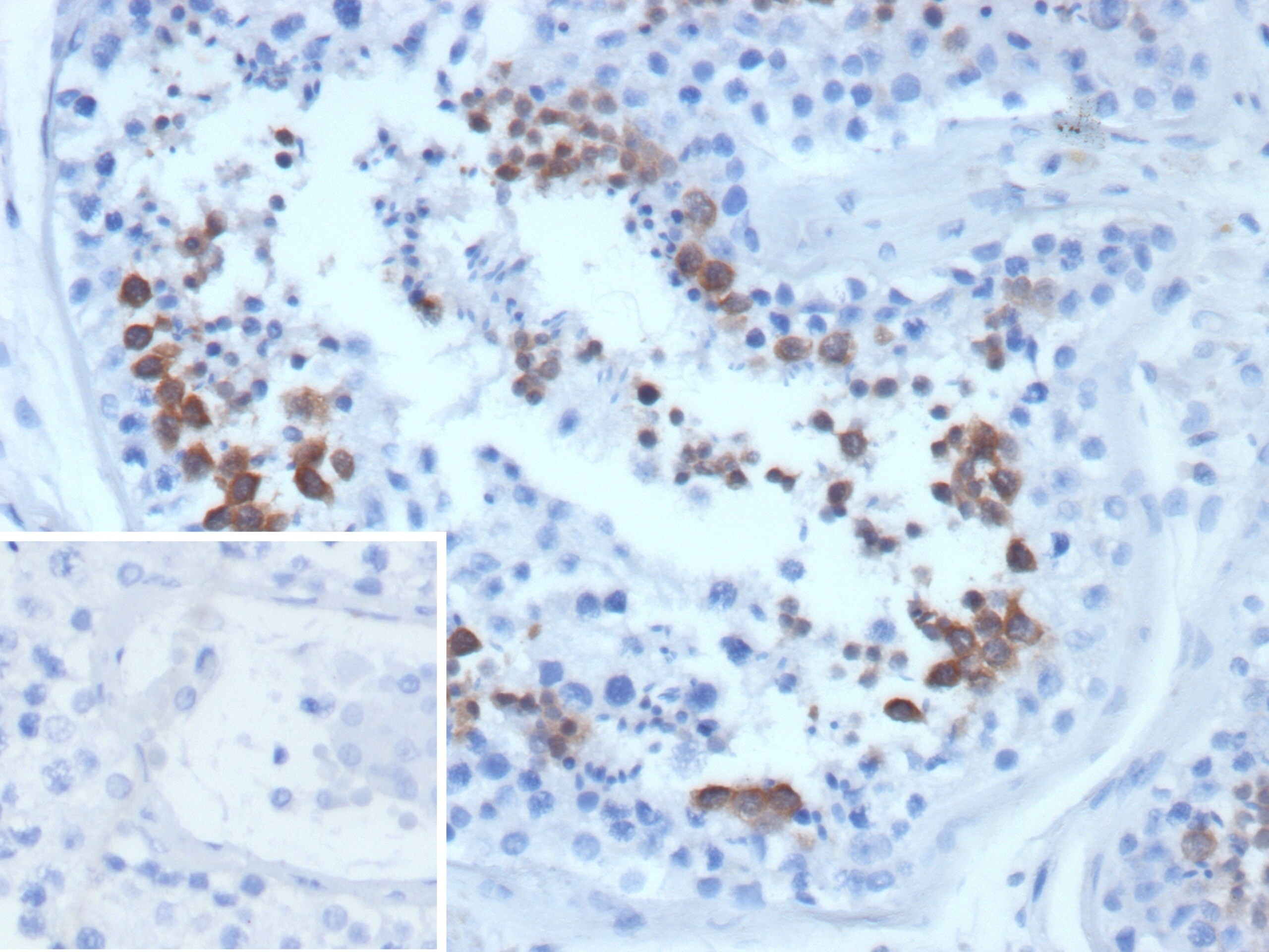 Centrin 1 Antibody (CETN1/9877) - Azide and BSA Free