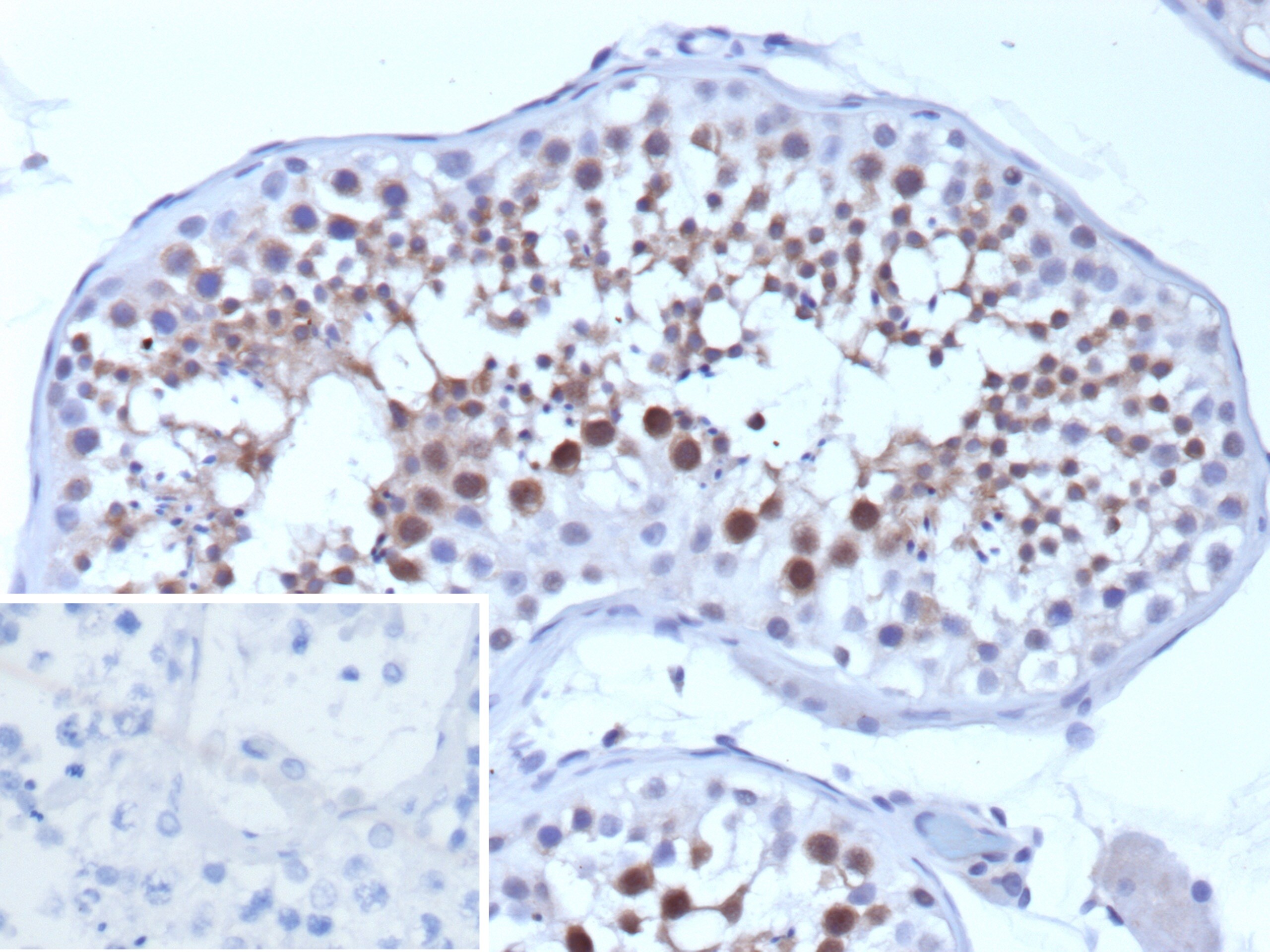 SMN Antibody (SMN1/1596) - Azide and BSA Free