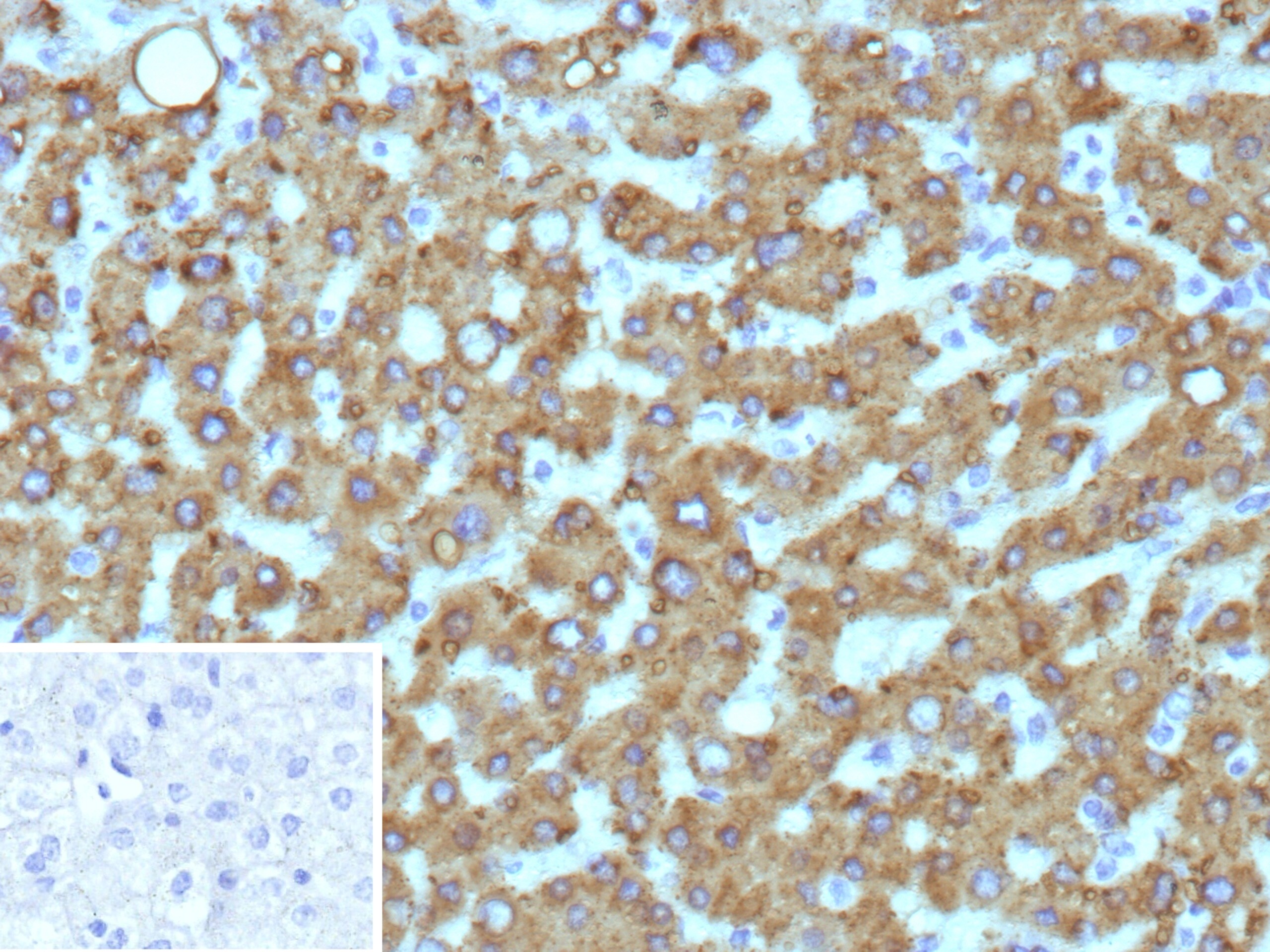 HSD17B13 Antibody (HSD17B13/13106) - Azide and BSA Free