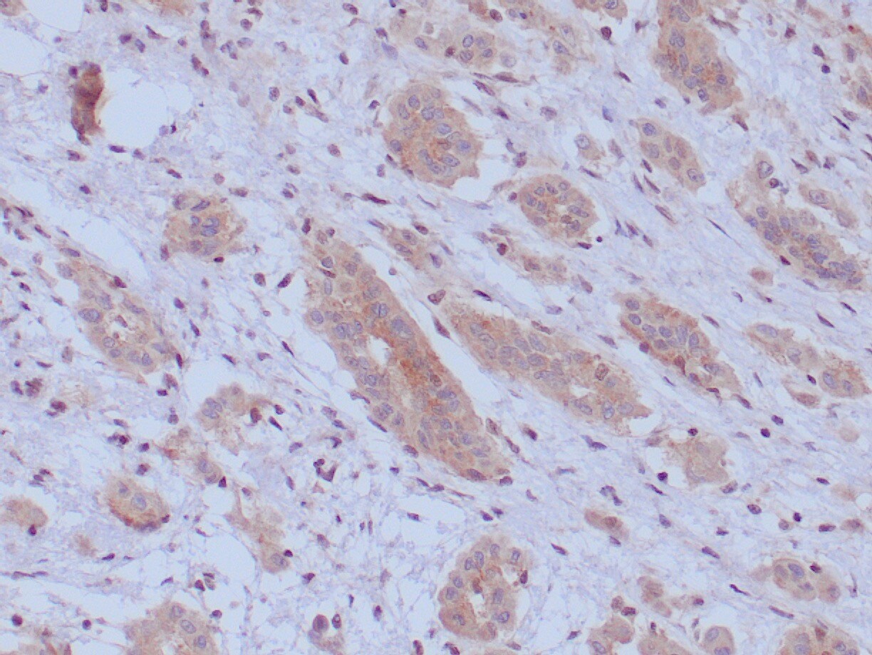 BAP1 Antibody (BAP1/13501R) - Azide and BSA Free