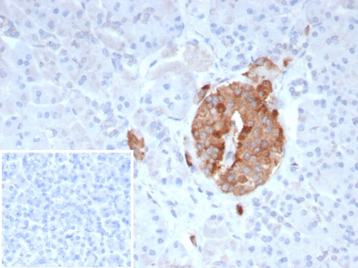 COL4A3 Antibody (COL4A3/9395R) - Azide and BSA Free
