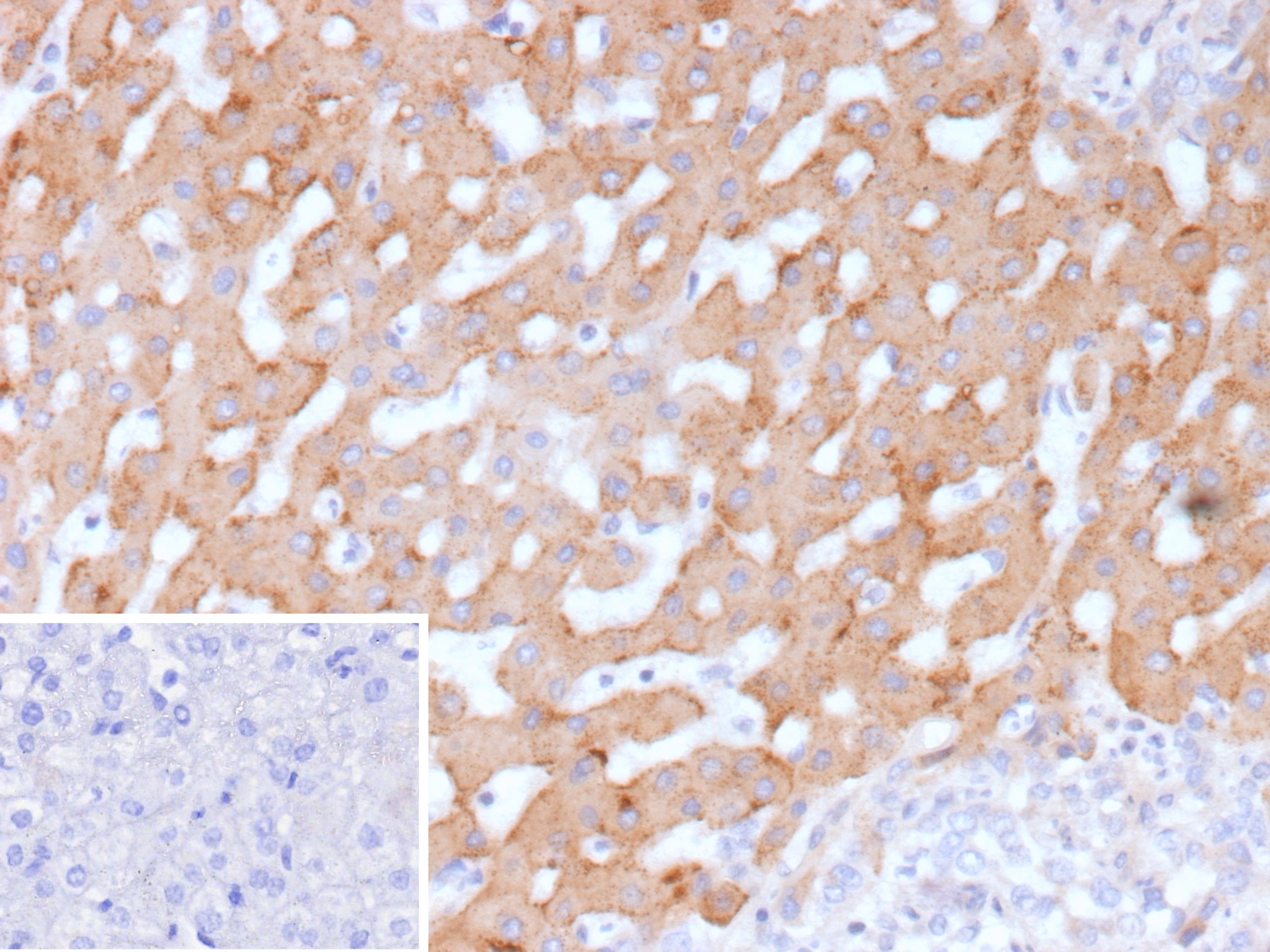 HSD17B13 Antibody (HSD17B13/13101) - Azide and BSA Free