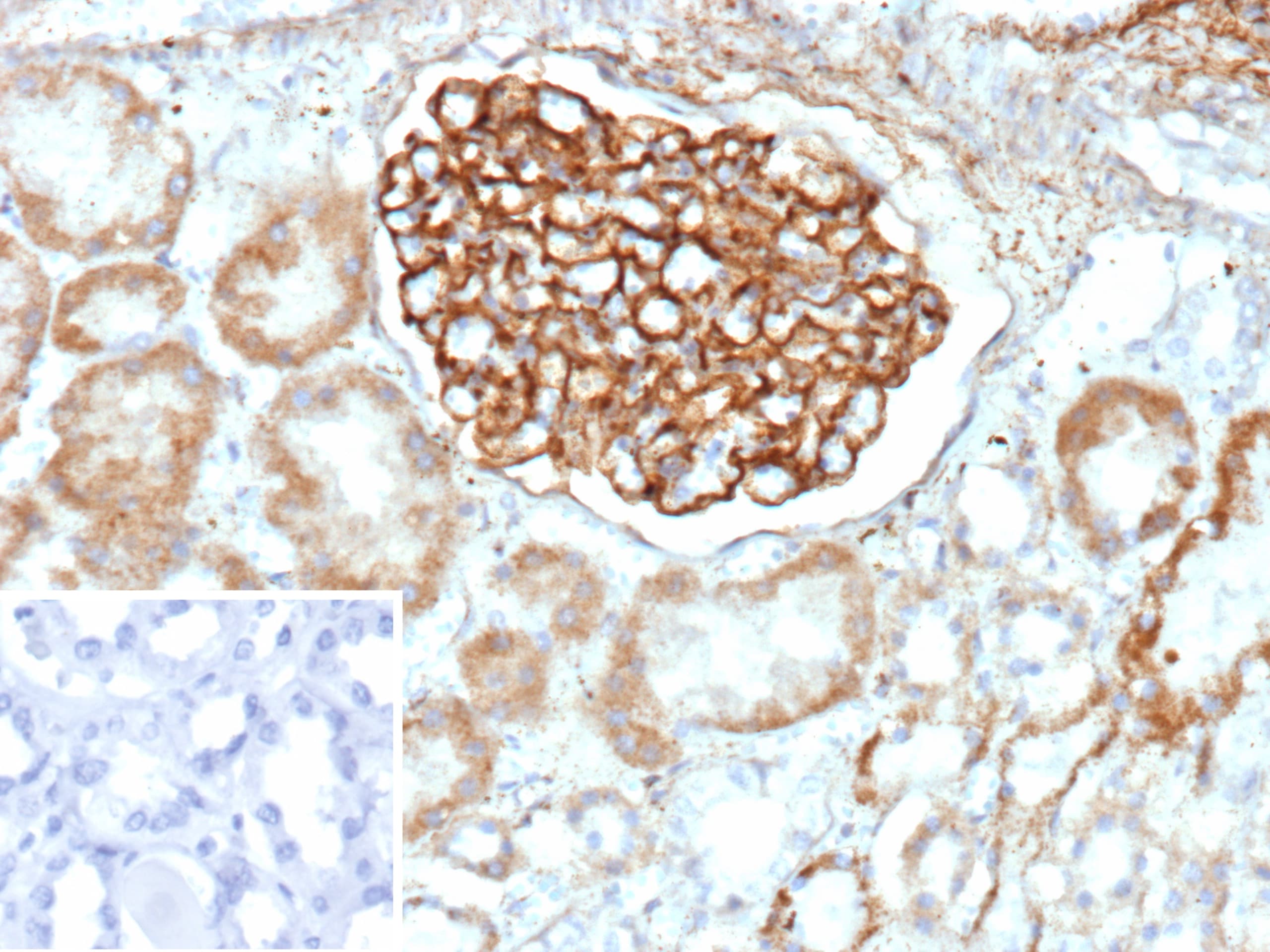 PLA2R1 Antibody (PLA2R1/4893) - Azide and BSA Free