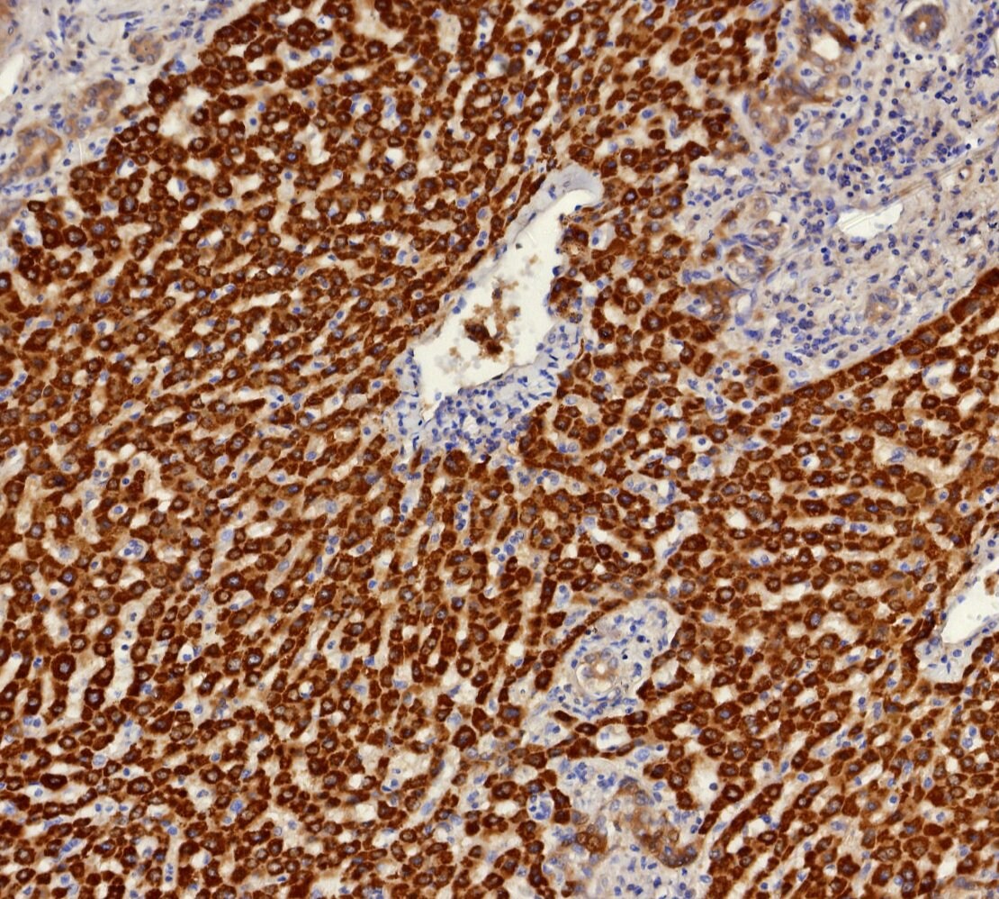 Aldo-keto Reductase 1C1/AKR1C1 Antibody (AKR1C1/9314) - Azide and BSA Free