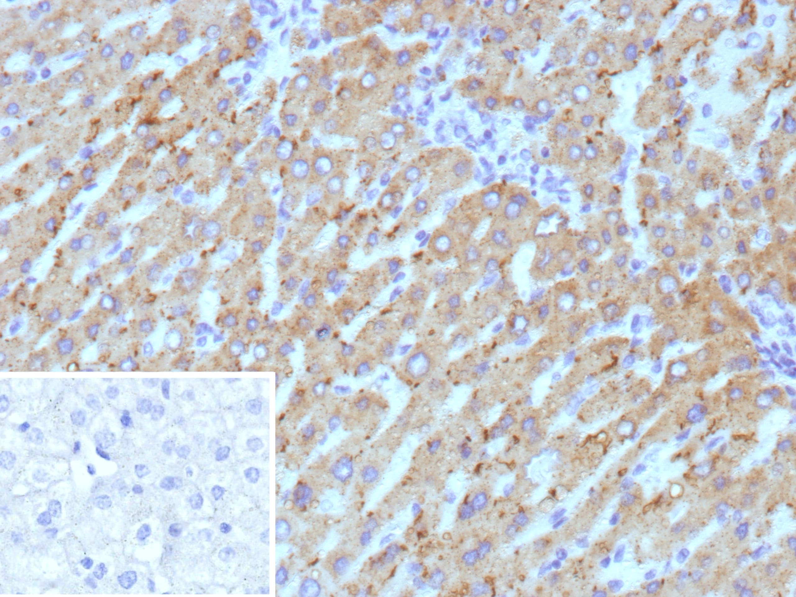 HSD17B13 Antibody (HSD17B13/13108) - Azide and BSA Free