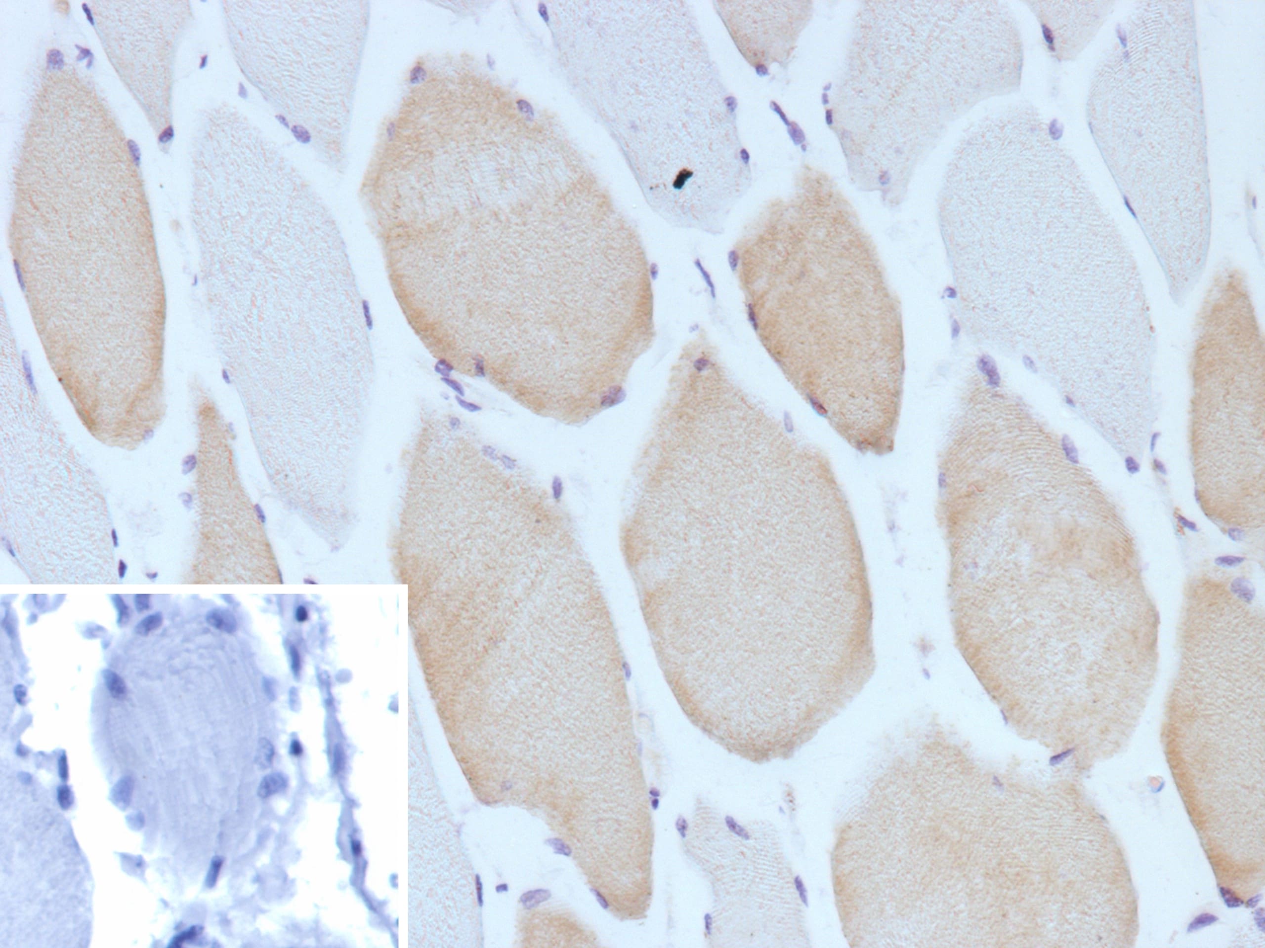 MYH7 Antibody (MYH7/13050R) - Azide and BSA Free