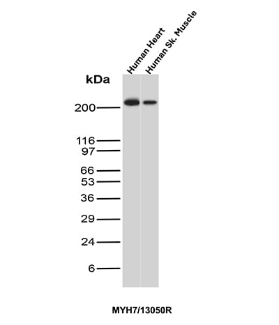 MYH7 Antibody (MYH7/13050R) - Azide and BSA Free