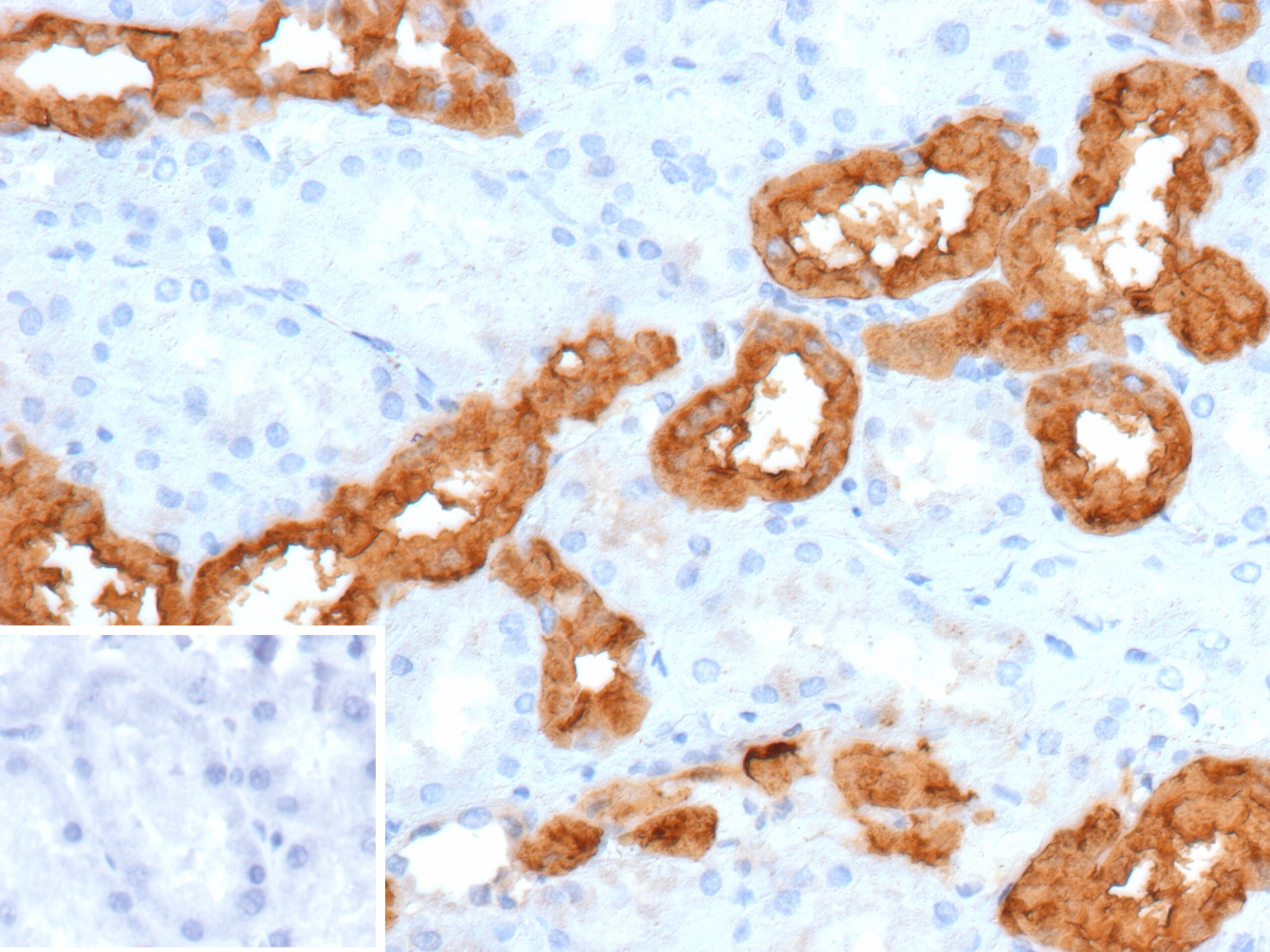 Calbindin D-28K Antibody (rCALB1/13280) - Azide and BSA Free